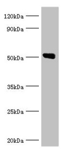 ANXA11 / Annexin XI Antibody - Western blot All lanes: Annexin A11 antibody at 14µg/ml + U251 whole cell lysate Secondary Goat polyclonal to rabbit IgG at 1/10000 dilution Predicted band size: 55, 52 kDa Observed band size: 52 kDa