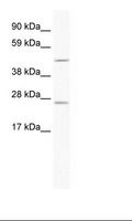 ANXA11 / Annexin XI Antibody - Fetal Thymus Lysate.  This image was taken for the unconjugated form of this product. Other forms have not been tested.
