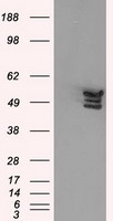 ANXA11 / Annexin XI Antibody - HEK293T cells were transfected with the pCMV6-ENTRY control (Left lane) or pCMV6-ENTRY ANXA11 (Right lane) cDNA for 48 hrs and lysed. Equivalent amounts of cell lysates (5 ug per lane) were separated by SDS-PAGE and immunoblotted with anti-ANXA11.
