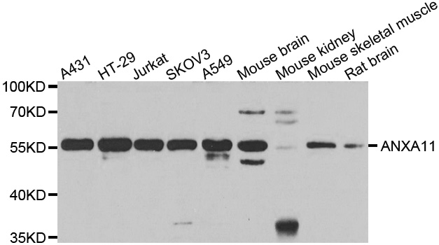 ANXA11 / Annexin XI Antibody - Western blot analysis of extracts of various cell lines.
