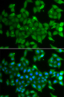 ANXA11 / Annexin XI Antibody - Immunofluorescence analysis of A549 cells.
