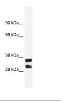 ANXA13 / Annexin XIII Antibody - Fetal Small intestine Lysate.  This image was taken for the unconjugated form of this product. Other forms have not been tested.