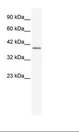 ANXA13 / Annexin XIII Antibody - Jurkat Cell Lysate.  This image was taken for the unconjugated form of this product. Other forms have not been tested.