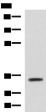 ANXA13 / Annexin XIII Antibody - Western blot analysis of Mouse small intestines tissue lysate  using ANXA13 Polyclonal Antibody at dilution of 1:800