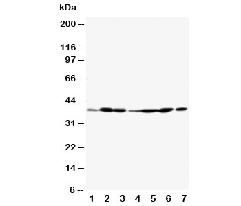 ANXA2 / Annexin A2 Antibody - Western blot testing of Annexin A2 antibody and Lane 1: rat testis; 2: rat lung; 3: rat ovary; 4: MCF-7; 5: SMMC-7721; 6: A549; 7: Jurkat