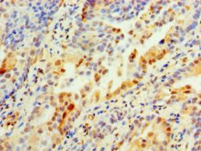 ANXA2 / Annexin A2 Antibody - Immunohistochemistry of paraffin-embedded human lung tissue using antibody at 1:100 dilution.  This image was taken for the unconjugated form of this product. Other forms have not been tested.