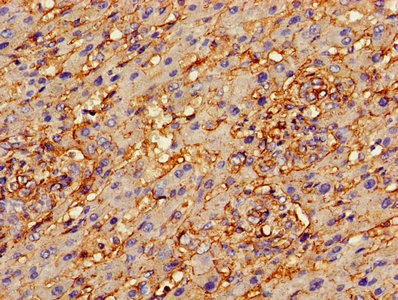 ANXA2 / Annexin A2 Antibody - Immunohistochemistry of paraffin-embedded human lung tissue using ANXA2 Antibody at dilution of 1:100