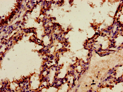 ANXA2 / Annexin A2 Antibody - Immunohistochemistry of paraffin-embedded human placenta tissue using ANXA2 Antibody at dilution of 1:100