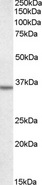 ANXA2 / Annexin A2 Antibody - Goat Anti-Annexin A2 Antibody staining (0.5?/ml) of A431 lysate (RIPA buffer, 35? total protein per lane). Primary incubated for 1 hour. Detected by western blot using chemiluminescence.