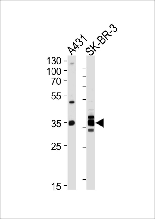ANXA2 / Annexin A2 Antibody - Western blot of lysates from A431, SK-BR-3 cell line (from left to right), using ANXA2 Antibody. Antibody was diluted at 1:1000 at each lane. A goat anti-rabbit IgG H&L (HRP) at 1:5000 dilution was used as the secondary antibody. Lysates at 35ug per lane.
