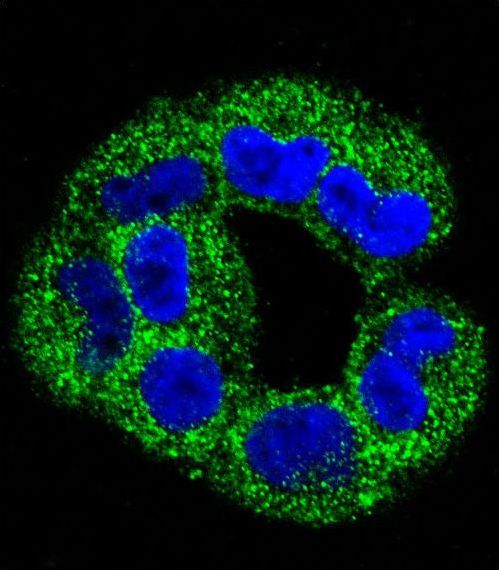 ANXA2 / Annexin A2 Antibody - Confocal immunofluorescence of ANXA2 Antibody with A2058 cell followed by Alexa Fluor 488-conjugated goat anti-rabbit lgG (green). DAPI was used to stain the cell nuclear (blue).