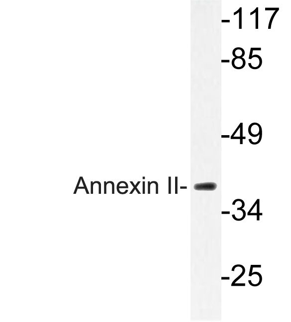 ANXA2 / Annexin A2 Antibody - Western blot of Annexin II (N137) pAb in extracts from HeLa cells.
