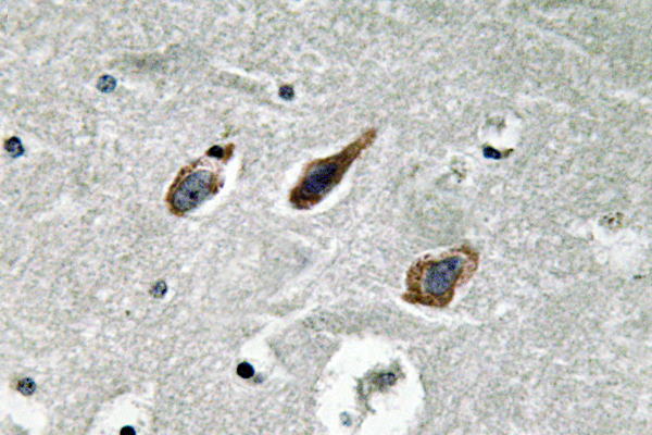ANXA2 / Annexin A2 Antibody - IHC of Annexin II (N137) pAb in paraffin-embedded human brain tissue.