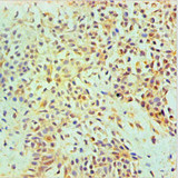 ANXA2 / Annexin A2 Antibody - Immunohistochemical of paraffin-embedded Human Breast tissue using ANXA2 Monoclonal Antibody at dilution of 1:200.