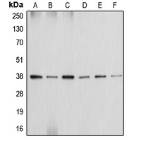 ANXA2 / Annexin A2 Antibody - Western blot analysis of Annexin A2 expression in HeLa (A); MCF7 (B); Raw264.7 (C); H9C2 (D); K562 (E); NIH3T3 (F) whole cell lysates.