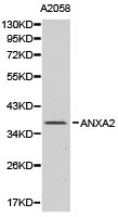 ANXA2 / Annexin A2 Antibody - Western blot of extracts of A2058 cell lines, using ANXA2 antibody.