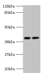 ANXA2 / Annexin A2 Antibody - Western blot All lanes: Annexin A2 antibody at 2µg/ml Lane 1: 293T whole cell lysate Lane 2: EC109 whole cell lysate Secondary Goat polyclonal to rabbit IgG at 1/15000 dilution Predicted band size: 39, 41 kDa Observed band size: 39 kDa