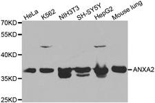 ANXA2 / Annexin A2 Antibody - Western blot analysis of extracts of various cell lines, using ANXA2 antibody at 1:1000 dilution. The secondary antibody used was an HRP Goat Anti-Rabbit IgG (H+L) at 1:10000 dilution. Lysates were loaded 25ug per lane and 3% nonfat dry milk in TBST was used for blocking.