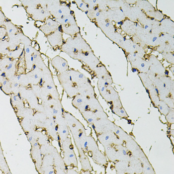 ANXA2 / Annexin A2 Antibody - Immunohistochemistry of paraffin-embedded rat heart using ANXA2 antibody at dilution of 1:100 (40x lens).