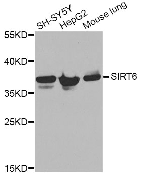 ANXA2 / Annexin A2 Antibody - Western blot analysis of extracts of various cell lines, using ANXA2 Antibody at 1:1000 dilution. The secondary antibody used was an HRP Goat Anti-Rabbit IgG (H+L) at 1:10000 dilution. Lysates were loaded 25ug per lane and 3% nonfat dry milk in TBST was used for blocking.