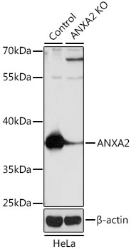ANXA2 / Annexin A2 Antibody - Western blot analysis of extracts from normal (control) and ANXA2 knockout (KO) HeLa cells, using ANXA2 antibody at 1:1000 dilution. The secondary antibody used was an HRP Goat Anti-Rabbit IgG (H+L) at 1:10000 dilution. Lysates were loaded 25ug per lane and 3% nonfat dry milk in TBST was used for blocking. An ECL Kit was used for detection and the exposure time was 3s.