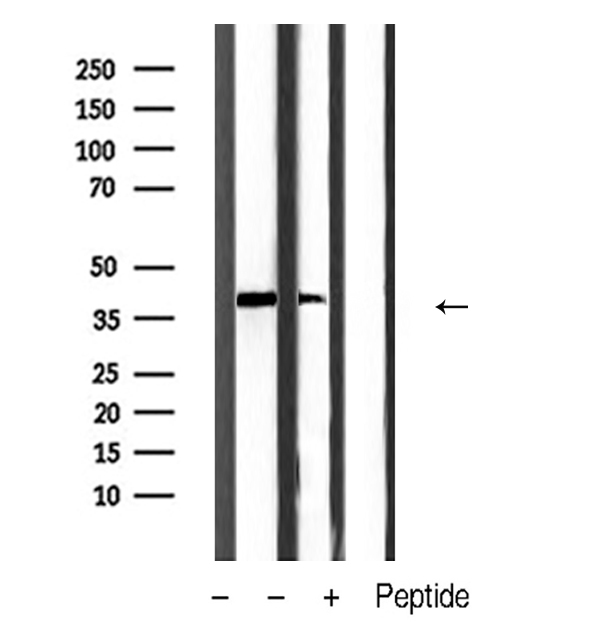 ANXA2 / Annexin A2 Antibody - Western blot analysis of extracts of mouse liver tissue using Annexin II antibody.