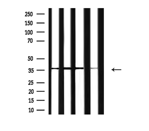 ANXA2 / Annexin A2 Antibody - Western blot analysis of extracts of rat brain, mouse brain, mouse muscle, rat liver tissue using Annexin II antibody.