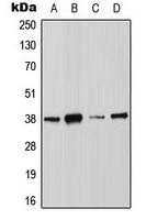 ANXA2 / Annexin A2 Antibody - Western blot analysis of Annexin A2 (pS26) expression in MCF7 (A); HCT116 (B); HeLa (C); NIH3T3 (D) whole cell lysates.