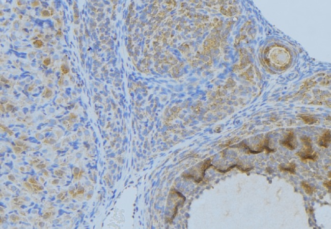 ANXA2 / Annexin A2 Antibody - 1:100 staining human uterus tissue by IHC-P. The sample was formaldehyde fixed and a heat mediated antigen retrieval step in citrate buffer was performed. The sample was then blocked and incubated with the antibody for 1.5 hours at 22°C. An HRP conjugated goat anti-rabbit antibody was used as the secondary.