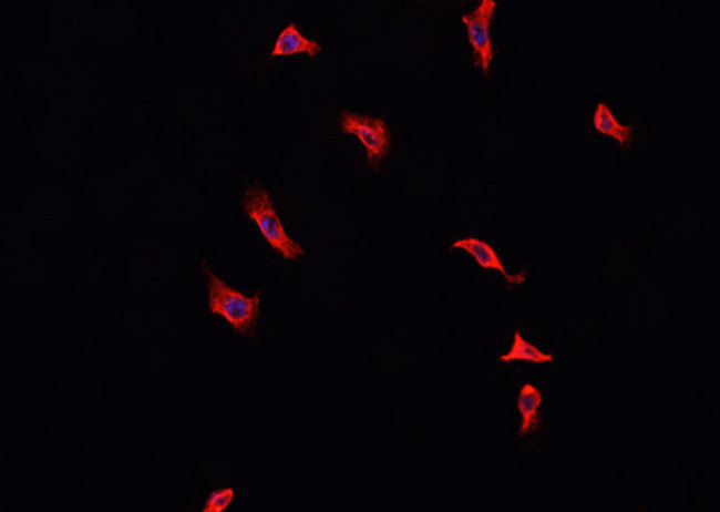 ANXA2 / Annexin A2 Antibody - Staining HeLa cells by IF/ICC. The samples were fixed with PFA and permeabilized in 0.1% Triton X-100, then blocked in 10% serum for 45 min at 25°C. The primary antibody was diluted at 1:200 and incubated with the sample for 1 hour at 37°C. An Alexa Fluor 594 conjugated goat anti-rabbit IgG (H+L) antibody, diluted at 1/600, was used as secondary antibody.