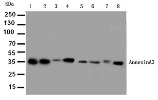 ANXA3 / Annexin A3 Antibody - WB of ANXA3 / Annexin A3 antibody. Lane 1: Rat Brain Tissue Lysate. Lane 2: Rat Testis Tissue Lysate. Lane 3: Rat Skeletal Muscle Tissue Lysate. Lane 4: Rat Lung Tissue Lysate. Lane 5: SW620 Cell Lysate. Lane 6: HELA Cell Lysate. Lane 7: SMMC Cell Lysate. Lane 8: MCF-7 Cell Lysate.