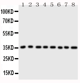 ANXA3 / Annexin A3 Antibody - Anti-Annexin A3 antibody, Western blotting All lanes: Anti Annexin A3 at 0.5ug/ml Lane 1: Rat Brain Tissue Lysate at 50ug Lane 2: Rat Testis Tissue Lysate at 50ug Lane 3: Rat Skeletal Muscle Tissue Lysate at 50ug Lane 4: Rat Lung Tissue Lysate at 50ug Lane 5: SW620 Whole Cell Lysate at 40ug Lane 6: HELA Whole Cell Lysate at 40ug Lane 7: SMMC Whole Cell Lysate at 40ug Lane 8: MCF-7 Whole Cell Lysate at 40ug Predicted bind size: 36KD Observed bind size: 36KD