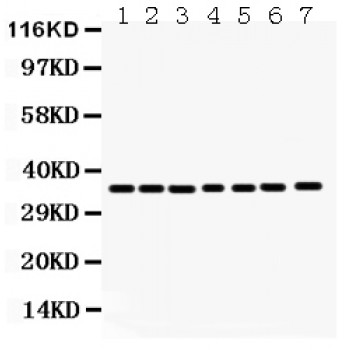 ANXA3 / Annexin A3 Antibody - Annexin A3 antibody Western blot. All lanes: Anti Annexin A3 at 0.5 ug/ml. Lane 1: Rat Spleen Tissue Lysate at 50 ug. Lane 2: Rat Stomach Tissue Lysate at 50 ug. Lane 3: HELA Whole Cell Lysate at 40 ug. Lane 4: 22RV1 Whole Cell Lysate at 40 ug. Lane 5: A549 Whole Cell Lysate at 40 ug. Lane 6: MCF-7 Whole Cell Lysate at 40 ug. Lane 7: SW620 Whole Cell Lysate at 40 ug. Predicted band size: 36 kD. Observed band size: 36 kD.
