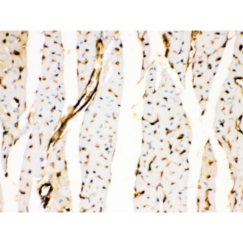 ANXA3 / Annexin A3 Antibody - Annexin A3 antibody IHC-paraffin. IHC(P): Rat Cardiac Muscle Tissue.