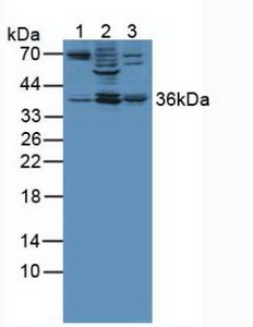 ANXA3 / Annexin A3 Antibody - Western Blot; Sample: Lane1: Human Liver Tissue; Lane2: Rat Placenta Tissue; Lane3: Rat Skeletal Muscle Tissue.