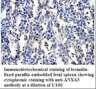 ANXA3 / Annexin A3 Antibody