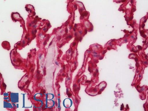 ANXA3 / Annexin A3 Antibody - Human Lung: Formalin-Fixed, Paraffin-Embedded (FFPE).  This image was taken for the unconjugated form of this product. Other forms have not been tested.