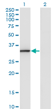 ANXA3 / Annexin A3 Antibody - Western blot of ANXA3 expression in transfected 293T cell line by ANXA3 monoclonal antibody (M07), clone 1E2.