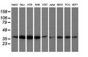 ANXA3 / Annexin A3 Antibody - Western blot analysis of extracts (35ug) from 9 different cell lines by using anti-ANXA3 monoclonal antibody.