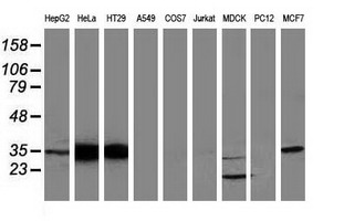 ANXA3 / Annexin A3 Antibody - Western blot of extracts (35 ug) from 9 different cell lines by using anti-ANXA3 monoclonal antibody (HepG2: human; HeLa: human; SVT2: mouse; A549: human; COS7: monkey; Jurkat: human; MDCK: canine; PC12: rat; MCF7: human).