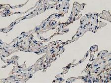 ANXA3 / Annexin A3 Antibody - IHC of paraffin-embedded Human lung tissue using anti-ANXA3 mouse monoclonal antibody.