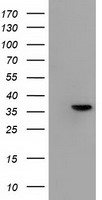ANXA3 / Annexin A3 Antibody - HEK293T cells were transfected with the pCMV6-ENTRY control (Left lane) or pCMV6-ENTRY ANXA3 (Right lane) cDNA for 48 hrs and lysed. Equivalent amounts of cell lysates (5 ug per lane) were separated by SDS-PAGE and immunoblotted with anti-ANXA3.