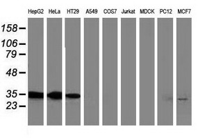 ANXA3 / Annexin A3 Antibody - Western blot of extracts (35 ug) from 9 different cell lines by using anti-ANXA3 monoclonal antibody (HepG2: human; HeLa: human; SVT2: mouse; A549: human; COS7: monkey; Jurkat: human; MDCK: canine; PC12: rat; MCF7: human).