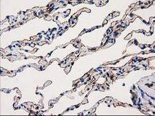 ANXA3 / Annexin A3 Antibody - IHC of paraffin-embedded Human lung tissue using anti-ANXA3 mouse monoclonal antibody.