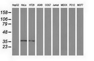 ANXA3 / Annexin A3 Antibody - Western blot of extracts (35 ug) from 9 different cell lines by using anti-ANXA3 monoclonal antibody.