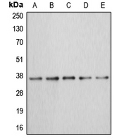 ANXA3 / Annexin A3 Antibody - Western blot analysis of Annexin A3 expression in MCF7 (A); HEK293T (B); HepG2 (C); mouse kidney (D); rat liver (E) whole cell lysates.