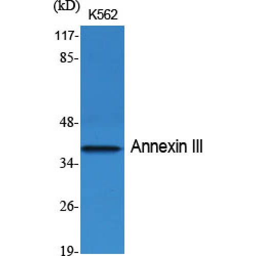 ANXA3 / Annexin A3 Antibody - Western blot of Annexin III antibody