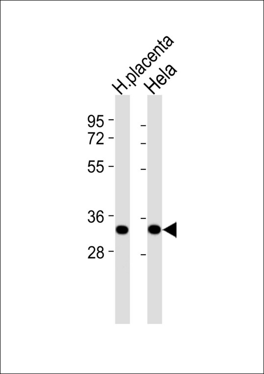 ANXA3 / Annexin A3 Antibody - All lanes : Anti-Annexin A3 Antibody at 1:1000 dilution Lane 1: human placenta lysates Lane 2: HeLa whole cell lysates Lysates/proteins at 20 ug per lane. Secondary Goat Anti-Rabbit IgG, (H+L),Peroxidase conjugated at 1/10000 dilution Predicted band size : 36 kDa Blocking/Dilution buffer: 5% NFDM/TBST.