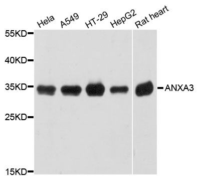 ANXA3 / Annexin A3 Antibody - Western blot analysis of extracts of various cell lines, using ANXA3 antibody at 1:3000 dilution. The secondary antibody used was an HRP Goat Anti-Rabbit IgG (H+L) at 1:10000 dilution. Lysates were loaded 25ug per lane and 3% nonfat dry milk in TBST was used for blocking. An ECL Kit was used for detection and the exposure time was 1s.