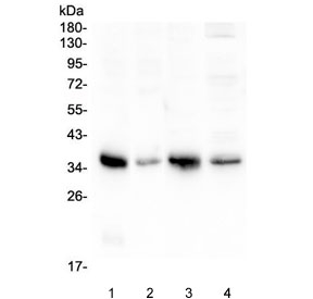 ANXA3 / Annexin A3 Antibody - Western blot testing of 1) rat lung, 2) rat ovary, 3) mouse lung and 4) mouse ovary with Annexin A3 antibody at 0.5ug/ml. Predicted molecular weight ~36 kDa.